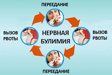 Лечение булимии в Романовской